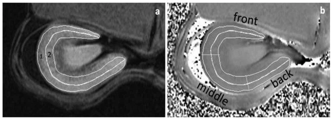 kidney fig. 1 kidney fig. 1