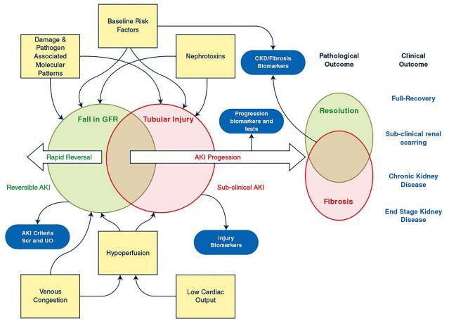 Simplifed overview of AKI pathophysiology illustrating the heterogeneity in etiology