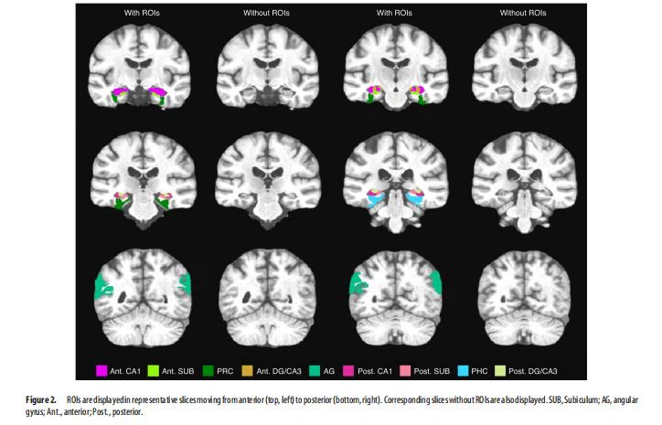 ROIs are displayed inrepresentative