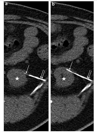 cistanche vitamin shoppe
